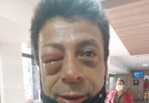 Saúde no DF está um caos : porteiro com choque anafilático não foi atendido no HRC